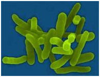 Shigella.